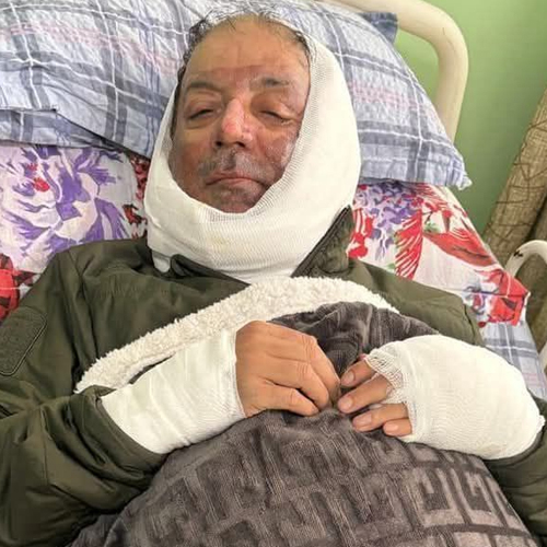 पोखरा महानगरपालिकाका मेयर आचार्य अस्पतालबाट डिस्चार्ज
